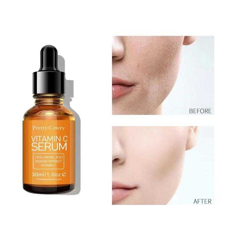 vitamine-c-serum-fytyre-online-ne-dyqan-taxi vitamine c serum fytyre online ne dyqan taxi